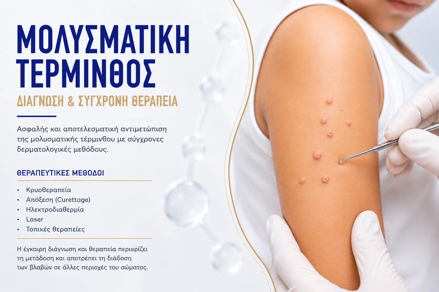 μολυσματική τέρμινθος μολυσματική τέρμινθος